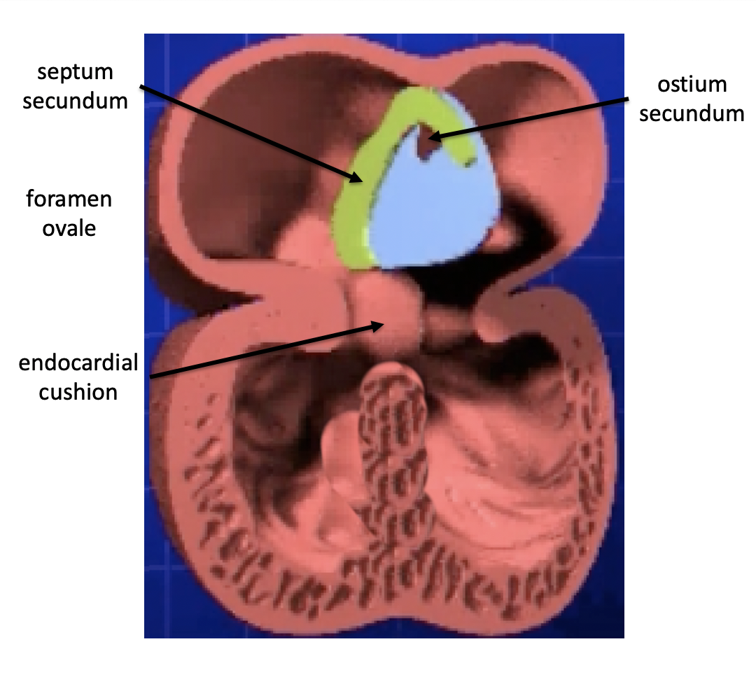 Partitioning of Heart | Embryology - A Web Site